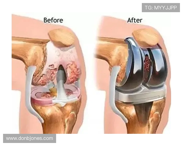 萨尔瓦多带伤复诊:鼻骨骨折伤情追踪 萨尔瓦多带伤复诊:鼻骨骨折伤情追踪